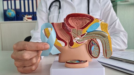 Alerta pel càncer de pròstata: diagnòstics tardans per por i tabús