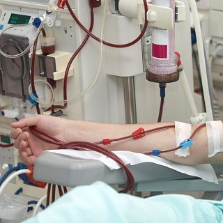 La terapia HDx, alternativa práctica a la hemodiafiltración