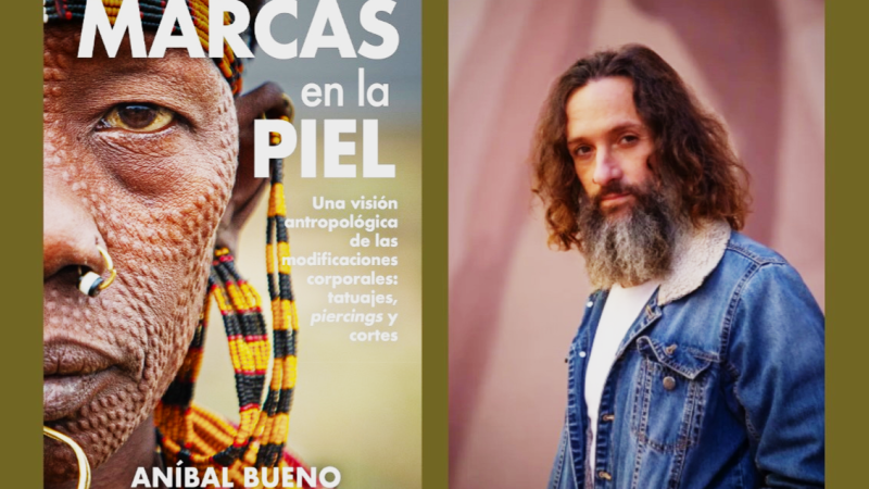 RaÍz de 5 - Conversaciones sobre culturas minoritarias y las marcas en la piel en el mundo - 12/07/26 - Escuchar ahora