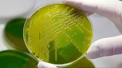 Entrenar bacterias para que coman bioplásticos
