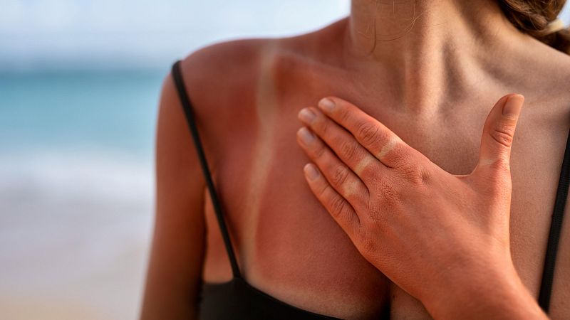 El negoci del bronzejat, mites i riscos per a la salut�� - El mat� de R�dio 4 | Escoltar