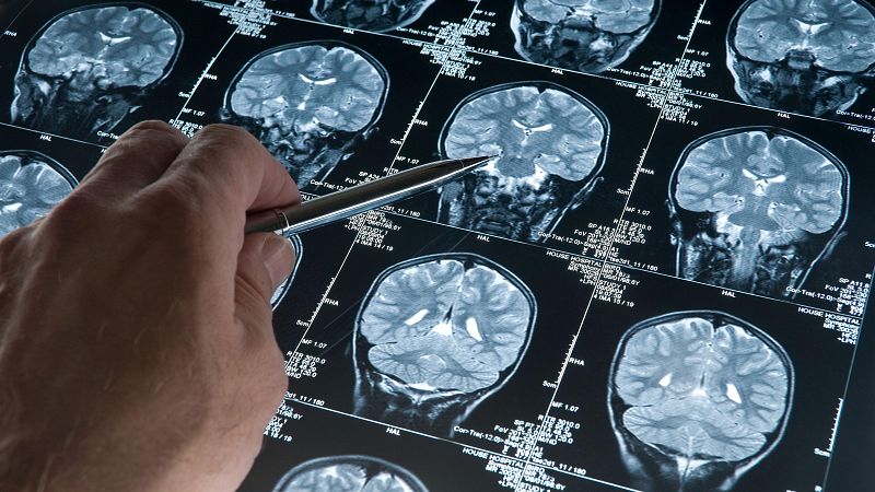 English Language Broadcast - Using AI to fight dementia - English Language Broadcast | Listen