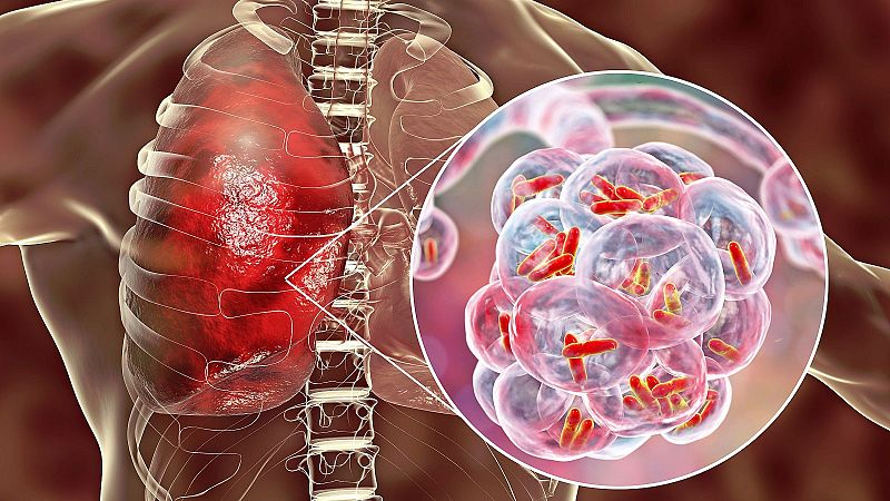 Marca España. A Ciencia Cierta. Vacuna contra la tuberculosis 08/10/26