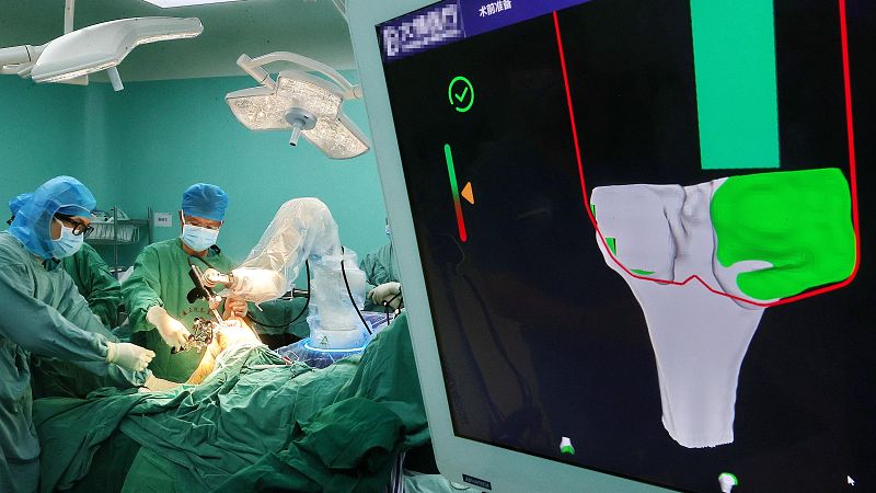 Cirujanos con indumentaria estéril realizan una intervención traumatológica asistida por un brazo robótico junto a un monitor con modelos óseos en 3D.