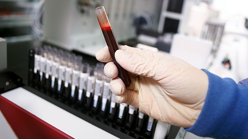 Radio 5 Actualidad - Un análisis de sangre para detectar si se ha sufrido un infarto - Escuchar ahora