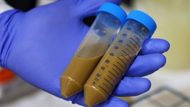 Esto me suena. Las tardes del Ciudadano García - Heces que salvan vidas - Escuchar ahora