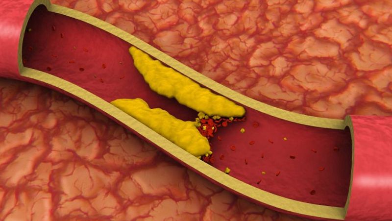 España vuelta y vuelta - Uno de cada dos españoles tiene colesterol - Escuchar ahora