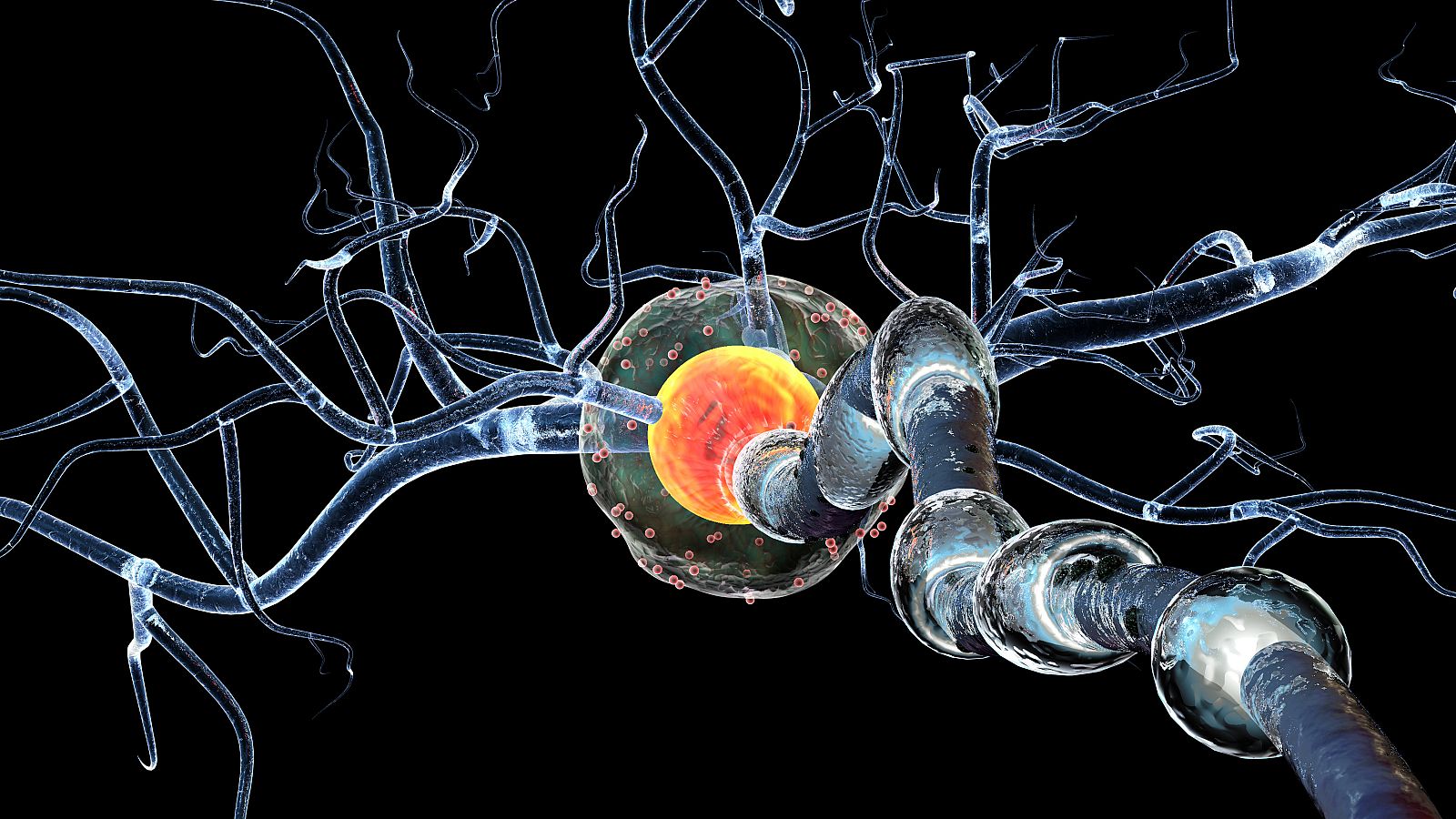 Marca España - Tratamientos e investigaciones en torno a la esclerosis múltiple - escuchar ahora