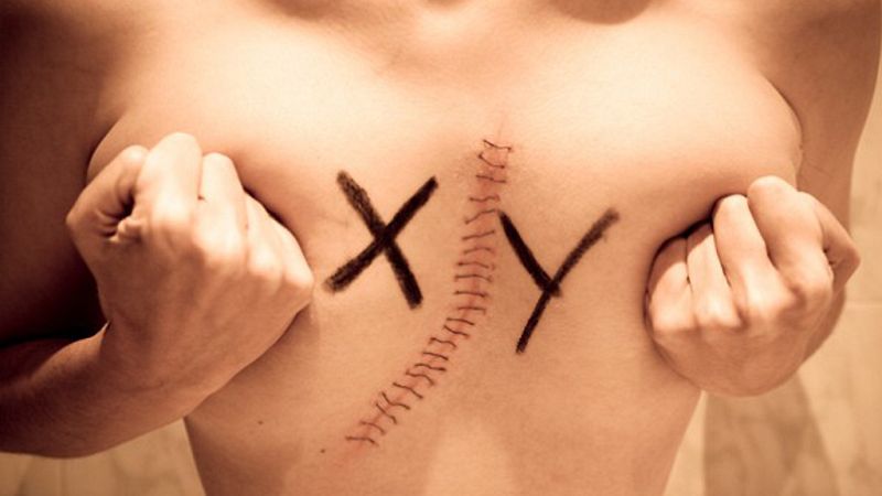 El canto del grillo - Intersexualidad: cuando la anatomía no encaja con el género - Escuchar ahora