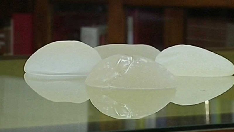 Europa abierta - Prótesis e implantes más seguros en la UE - 12/04/17 - escuchar ahora