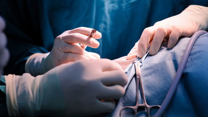 El canto del grillo - Cirugía torácica no invasiva y más efectiva