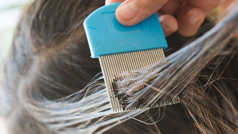 Esto me suena. Las tardes del Ciudadano García - Los piojos: ¿cada vez más resistentes? - Escuchar ahora