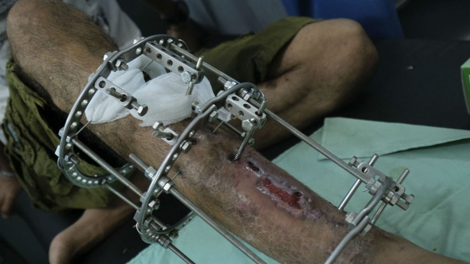 Cinco continentes - Las heridas de Gaza - 09/11/18 - Escuchar ahora