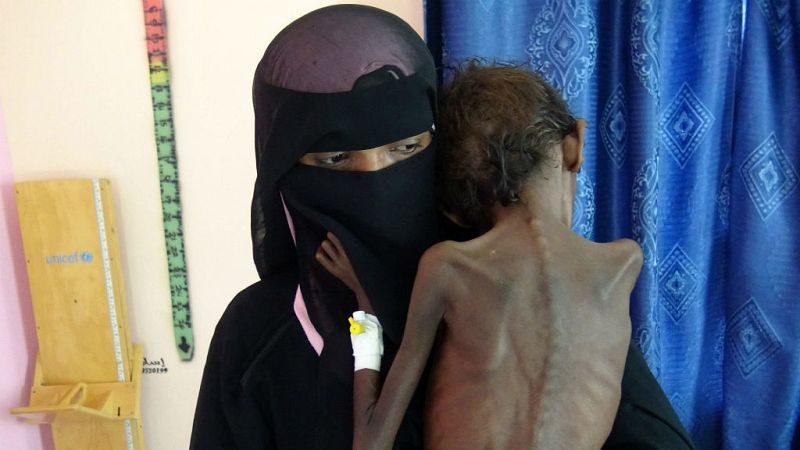 Boletines RNE - Yemen se desangra por la guerra que soporta desde hace cuatro años - 23/11/18 - Escuchar ahora