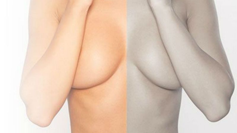 14 horas - ¿Cómo actuará España en el caso de los implantes? - escuchar ahora