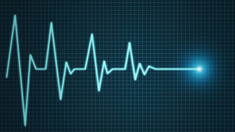 Nuevo paso en el caso de Vincent Lambert - escuchar ahora