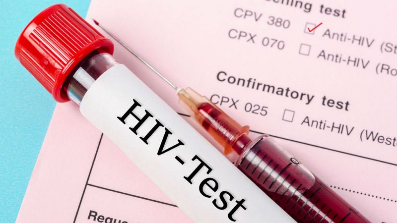 14 horas - Se reducen las muertes por SIDA pero aumentan los contagios