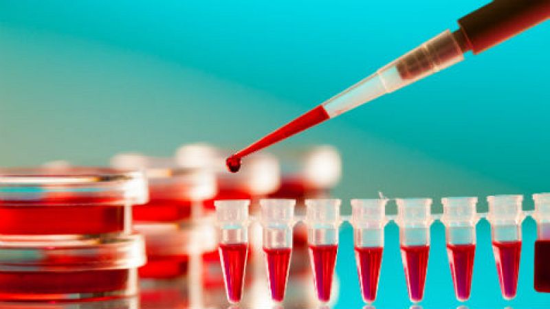 24 horas - Descubren un fármaco que elimina las células que reactivan el VIH