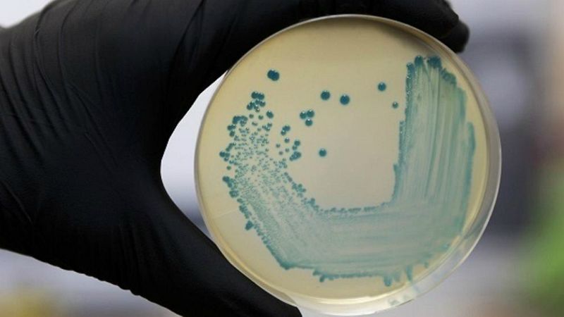 Las mañanas de RNE con Íñigo Alfonso - Listeriosis | El autocontrol en las empresas alimenticias - Escuchar ahora