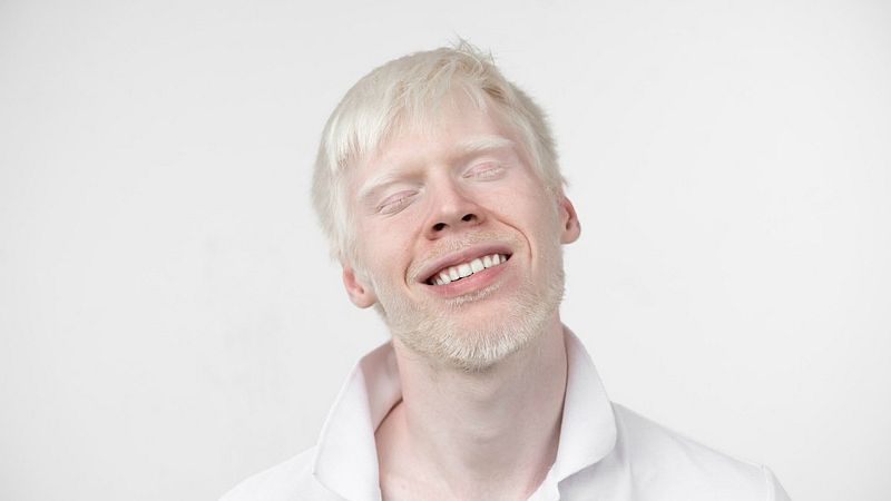 Tres mundos, solidaridad - Extremadura con los Albinos - 21/10/19 - Escuchar ahora