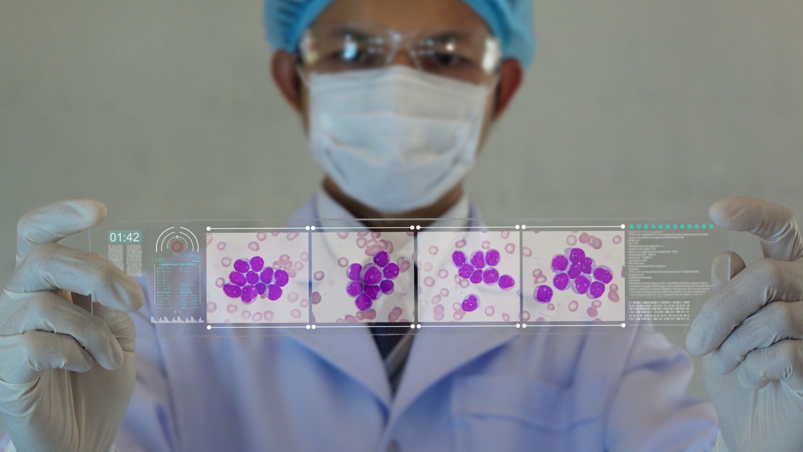 24 horas - En un lugar de la ciencia: Los patrones del cáncer - Escuchar ahora