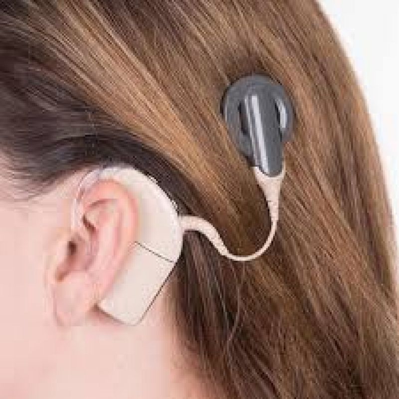 Día internacional del implante coclear - 25/02/20 - Escuchar ahora