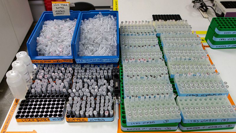 Test de detección, herramienta clave para planificar la vuelta a la normalidad - 14 horas | Escuchar