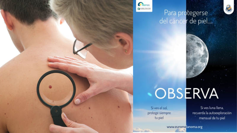 Todo Noticias Mañana - Protección solar y autoexploración, claves contra el melanoma - Escuchar ahora