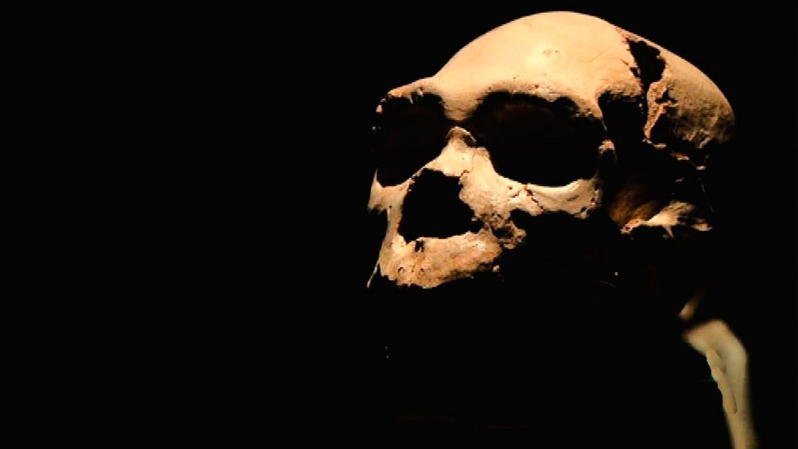 Marca España - La que podría ser la operación de oído más antigua del mundo - 23/07/20 - escuchar ahora