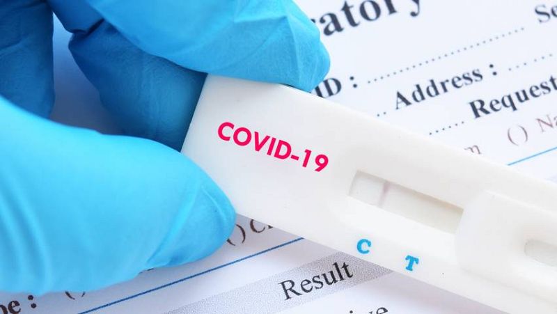 14 horas - La palabra "COVID" ya está en la RAE y puede usarse en masculino o femenino