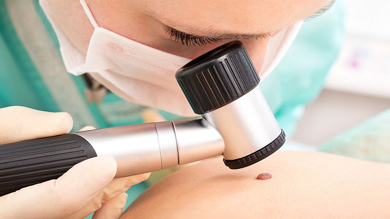 El gallo que no cesa - ¿Por qué el melanoma es uno de los tumores más agresivos?