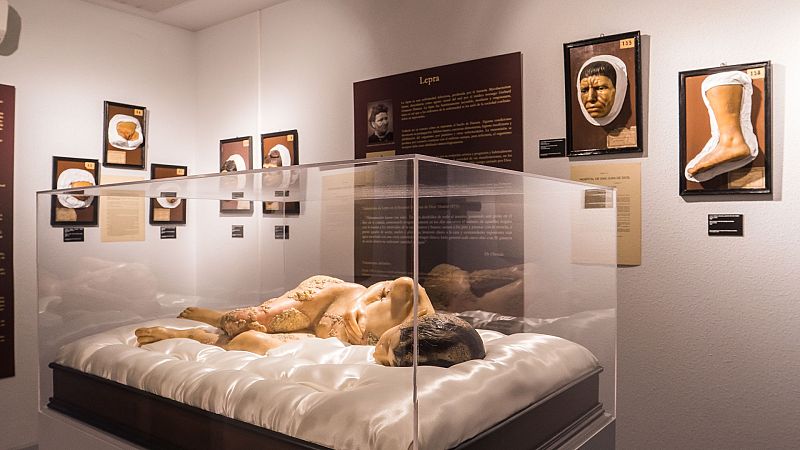 Más cerca - El doctor Olavide y los primeros pasos de la dermatología - Escuchar ahora