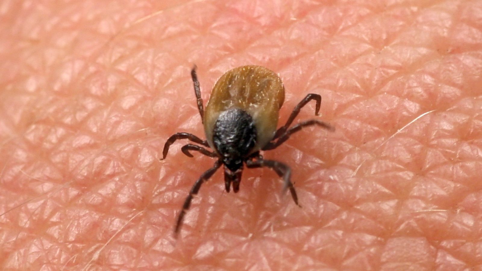 Punto de enlace - Lyme, la enfermedad oculta que transmiten las garrapatas - escuchar ahora