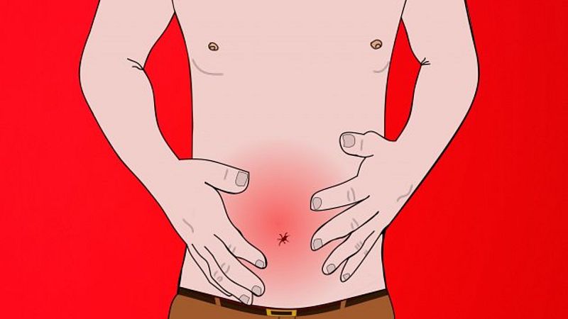 El gallo que no cesa - Médico de guardia: ¿Qué son las hernias abdominales?