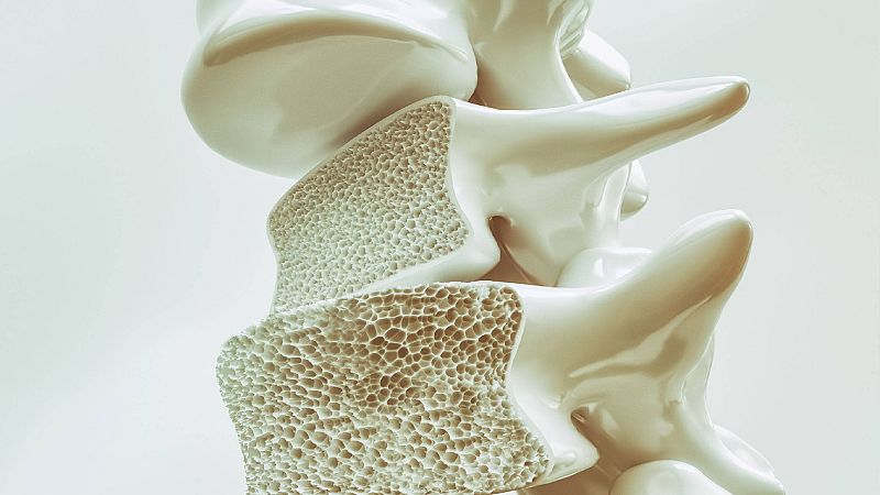 A su salud - Día Mundial de la Osteoporosis - 22/10/21