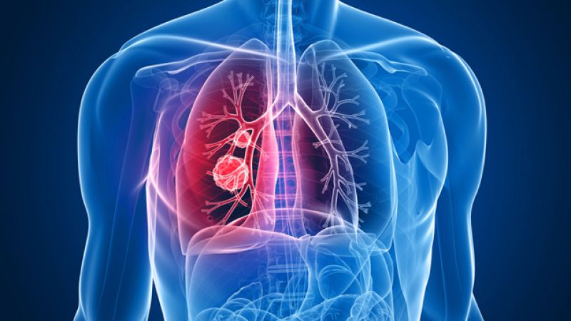 La AECC pide más espacios libres de humo - 17/11/21 - Escuchar ahora