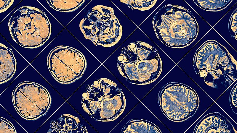 Tarde lo que tarde - Día mundial del párkinson - 11/04/22 - escuchar ahora