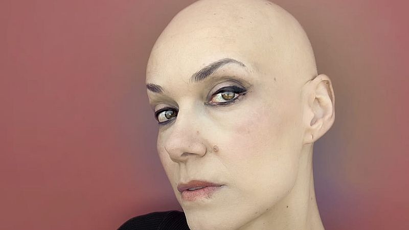 Radiogramas - Las mujeres calvas existen, Dora Gálvez en Radiogramas - 10/10/22