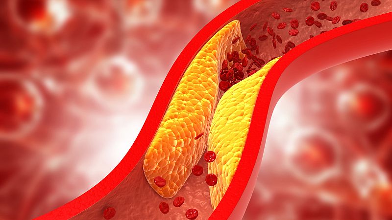 Con bata blanca - La menopausia sube entre un 10% y un 15% el colesterol malo - 06/10/23 - escuchar ahora