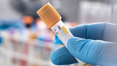 Es constata l'alta efectivitat dels nous tractaments antiretrovirals | ANNA BAÑERES