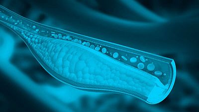 IA en l'àmbit de la salut i les finances: l'aposta de les start-ups | Climent Sabater