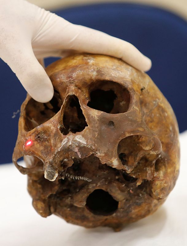 La calavera del nazi Josef Mengele, expuesta en la Facultad de Medicina de Sao Paulo