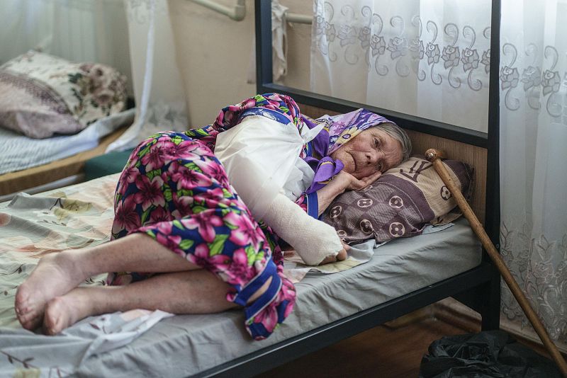 Mujer mayor en cama, con brazo vendado y expresión triste.  A su lado, un bastón.  Ambiente de hospital o residencia.