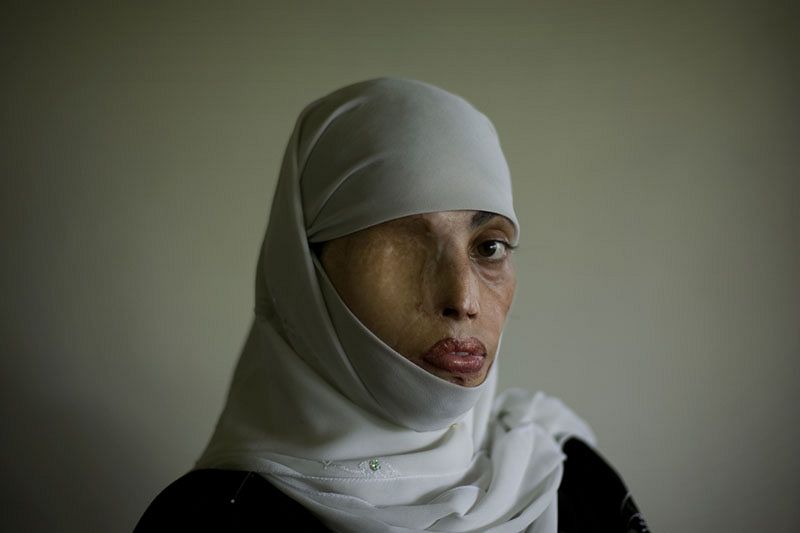 Mujer maltratada