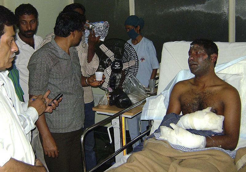 A survivor of the crashed Air India Express passenger plane rests inside a hospital in Mangalore