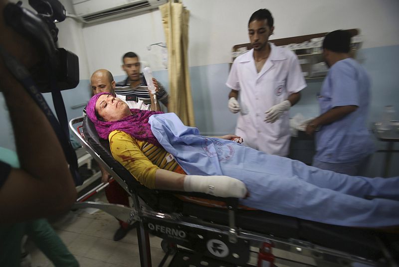 Al menos 17 personas han resultado heridas en los bombardeos