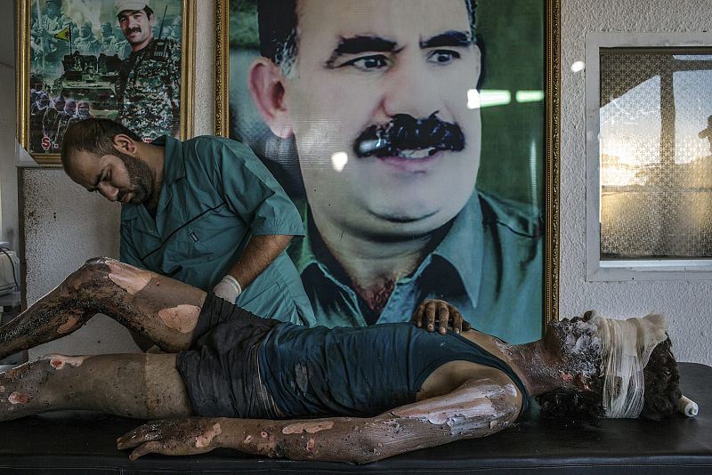fotografía ganadora del premio de la categoría de noticias de actualidad de la 59 edición del World Press Photo, tomada por el fotógrafo brasileño del New York Times Mauricio Lima