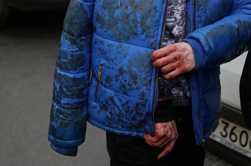Un herido de la explosión ocurrida en la estación de metro de San Petersburgo Sennaya Ploshchad.
