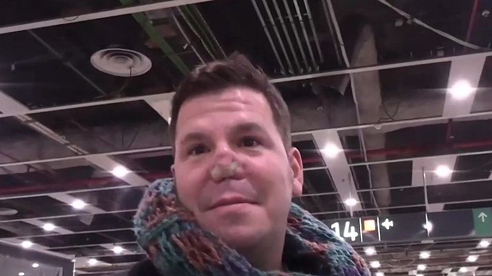 Exclusiva Mamarazzis: El nas d?en Lucas requerir una costella i retocs finals