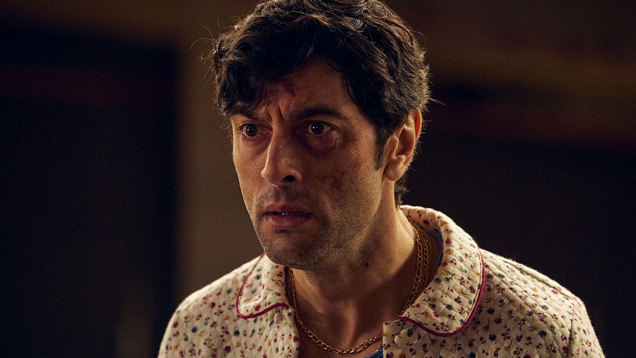 Primer plano de un hombre con cabello oscuro y corto, mostrando marcas en su rostro. Viste una camisa estampada con detalles rojos y una cadena dorada, con una expresión facial que denota sorpresa.